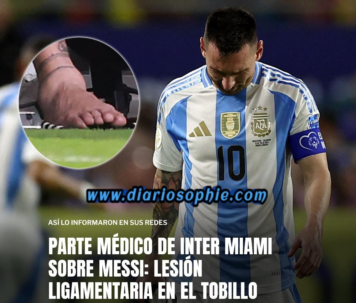🚨 ATENCIÓN: MESSI SUFRIÓ UNA LESIÓN LIGAMENTARIA EN SU TOBILLO DERECHO.