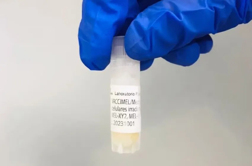 ARGENTINA COMIENZA A COMERCIALIZAR VACCIMEL, LA VACUNA DESARROLLADA CONTRA EL MELANOMA