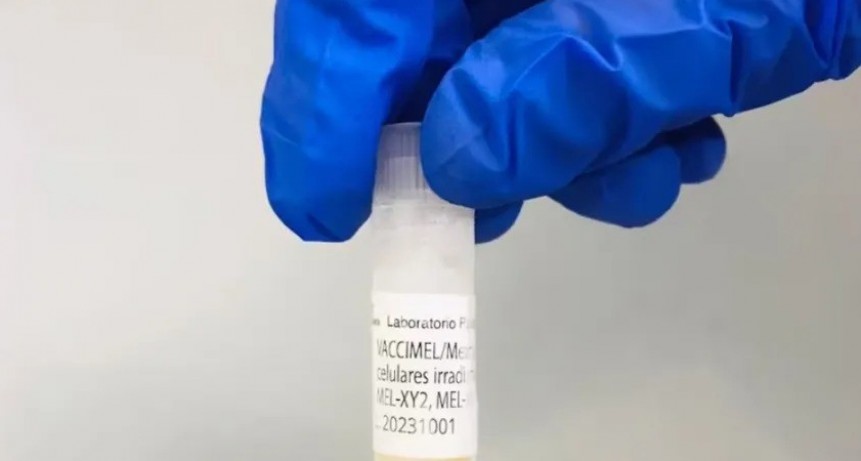 ARGENTINA COMIENZA A COMERCIALIZAR VACCIMEL, LA VACUNA DESARROLLADA CONTRA EL MELANOMA